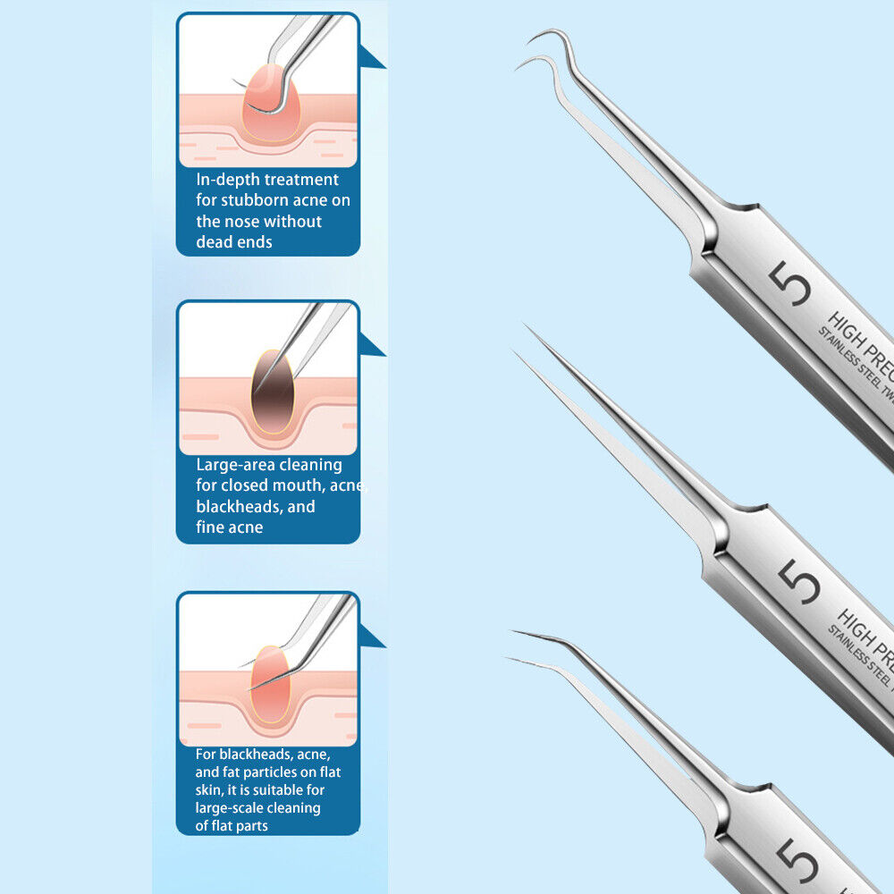 Blackhead Removal Needles