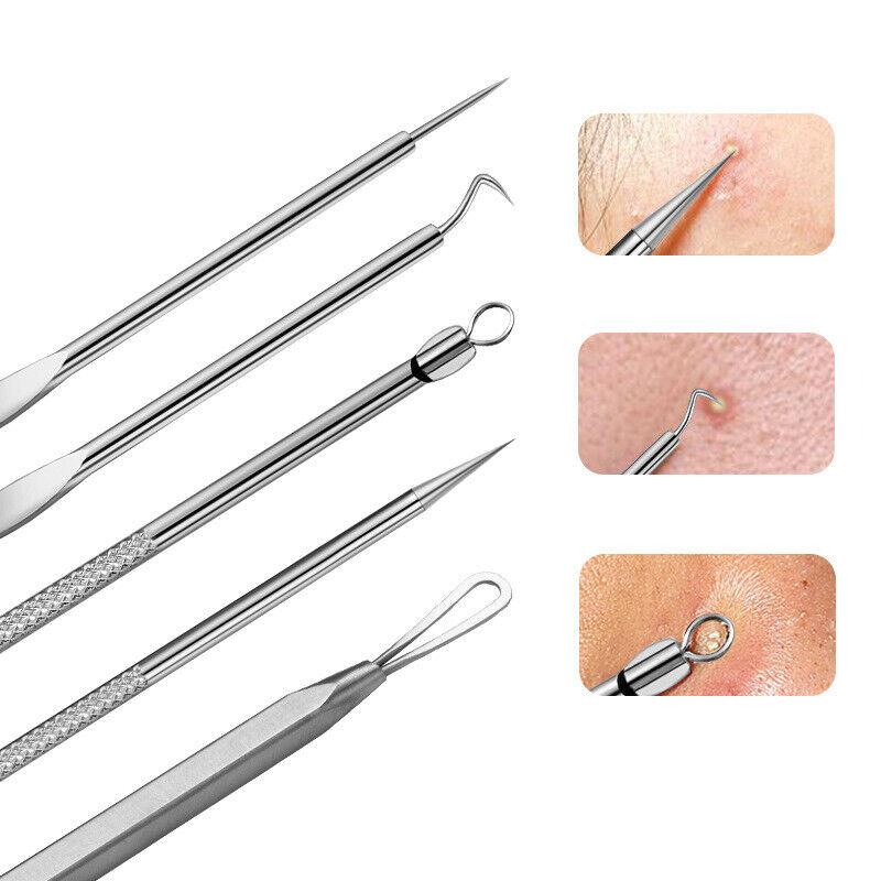 Acne Needle Tools