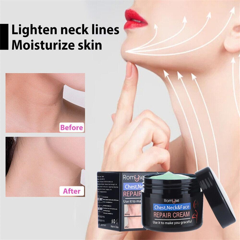 Neck Wrinkles Cream