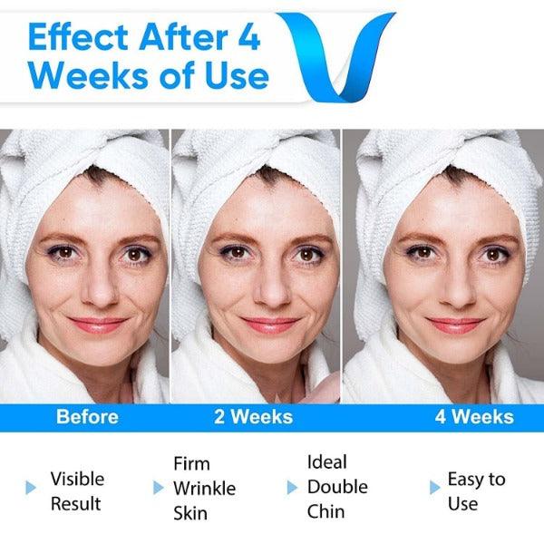 Electric Facial Slimming