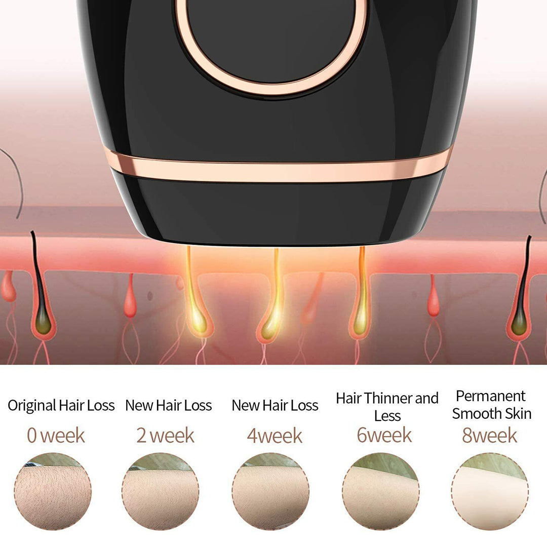 	 price of laser hair removal machine