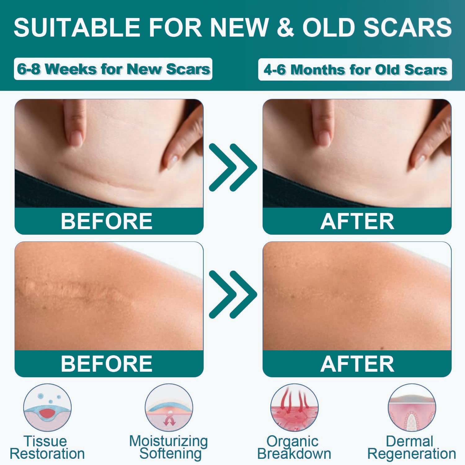 Surgeries Scars tape