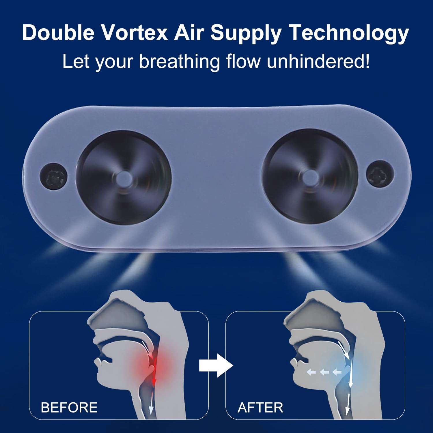 device for sleep apnea