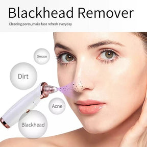 Best Blackhead Remover Suction