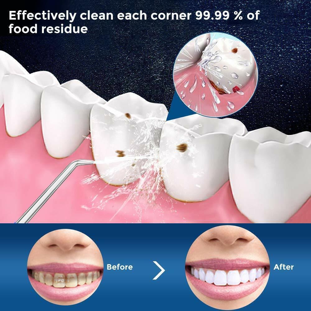 Waterpik Teeth Flosser