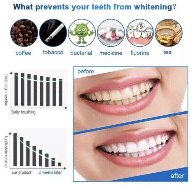 Best Whitening Strips