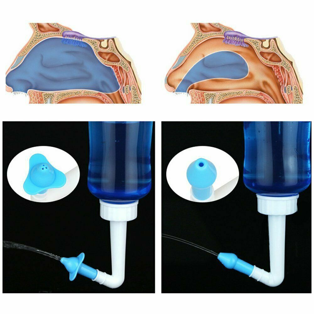 Neilmed Sinus Rinse